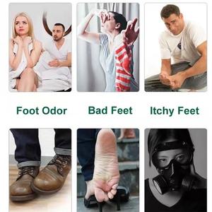 Krim penghilang bau, salep penyembuh penyakit kaki beri-beri Anti gatal keringat kaki - Product Image 5