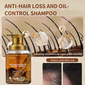 Fabricant chinois de shampooing anti-perte de <span class=keywords><strong>cheveux</strong></span> pour <span class=keywords><strong>cheveux</strong></span> <span class=keywords><strong>bouclés</strong></span> <span class=keywords><strong>et</strong></span> abîmés Fonction de promotion <span class=keywords><strong>et</strong></span> de prévention de la croissance des <span class=keywords><strong>cheveux</strong></span> - Product Image 3