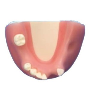 Modelo Dental Star con Dientes Faltantes 55-2 para Uso Educativo - Product Image 3