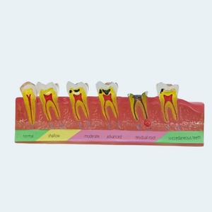 Modèle pédagogique d'hygiène bucco-dentaire : Manuel, caries dentaires, accessoires de soins dentaires, équipement de thérapie orale - Product Image 3
