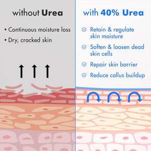 <span class=keywords><strong>Urea</strong></span> Cream <span class=keywords><strong>40</strong></span> Percent for Feet Plus 2% <span class=keywords><strong>Crema</strong></span> para pies con ácido salicílico y <span class=keywords><strong>crema</strong></span> para manos Máxima fuerza Hidrata profundamente - Product Image 6