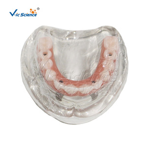 Modèle de Restauration d'Implant Maxillaire M6001-1, Structure de Prothèse Dentaire Démontable, Aide Pédagogique pour la Formation Dentaire - Product Image 1
