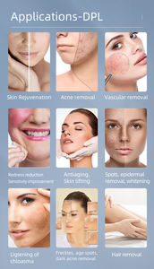 Cuidado Facial DPL para Tratamientos Estéticos, Depilación, Terapia Vascular para el Acné, Aclaramiento de la Piel, Antienvejecimiento, Limpieza Facial DPL - Product Image 6