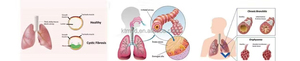 KT-I134 Hochleistungs-Weste zur Atemwegsreinigung für Thorax-Physiotherapie bei Kindern und Erwachsenen - Product Image 4