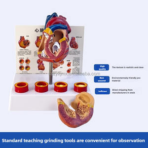 Modelo anatómico <span class=keywords><strong>de</strong></span> corazón humano <span class=keywords><strong>de</strong></span> tamaño real desmontable con trombo para ciencia médica - Product Image 4