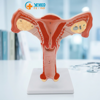 Modèles éducatifs en PVC de haute qualité, modèle d'anatomie humaine normale, modèle d'utérus, organes reproducteurs féminins pour l'enseignement CE/ISO