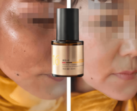 Sérum Correcteur de Taches Noires et Hyperpigmentation Visage Anti-Acné OEM Éclaircissant Soin Peau