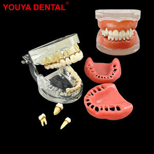 Model Gigi Resin Penyakit <span class=keywords><strong>Periodontal</strong></span> Model Gigi Anatomi untuk Mahasiswa Kedokteran Gigi Gusi Lunak Gigi Lepas Typodont Pasien - Product Image 1
