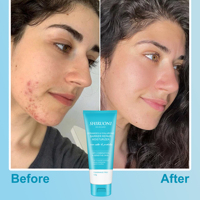 Crème Hydratante Visage Réparatrice Anti-Acné à la Protéine de Riz, Anti-Rides, Éclaircissante, Blanchissante, Hydratante, Raffermissante et Illuminatrice pour le Soin du Visage