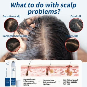 Sérum Nourrissant OEM 25ml pour Cheveux en Roll-on Traitement Capillaire pour Augmenter l'Épaisseur Équilibrer le Sébum Renforcer les Racines et Améliorer la Santé du Cuir Chevelu - Product Image 4
