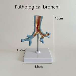 Modelo de Enseñanza Médica, Modelo de Anatomía Patológica de las Bronquias para la Educación en Medicina Respiratoria y Pulmonología - Product Image 5