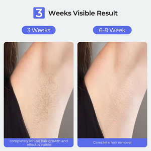 2025 <span class=keywords><strong>Ipl</strong></span>-машина для домашнего использования 22J безлимитный эпилятор для безболезненного сапфирового льда - Product Image 6