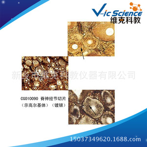 Spinal ganglion sections, cell biology and genetics, plant and animal slides, <b>microscope</b> slides - Product Image 5