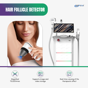 Medicina estética 755 808 1064nm Máquina de depilación láser de diodo Eliminador de tatuajes Láser Nd Yag - Product Image 6