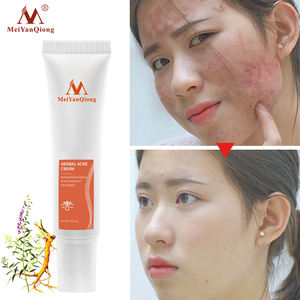 <span class=keywords><strong>Pommade</strong></span> anti-acné pour enlever les points noirs Crème anti-acné Contrôle de l'huile Rétrécir les pores Cicatrice d'acné Supprimer les soins du <span class=keywords><strong>visage</strong></span> Crème blanchissante - Product Image 3