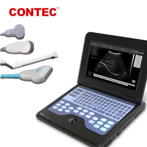 <span class=keywords><strong>Machine</strong></span> à ultrasons portable Contecmed échographie humaine vétérinaire portable - Product Image 3