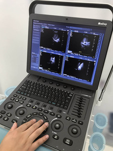 CE ISO disetujui sonobape <span class=keywords><strong>S8exp</strong></span> warna Doppler portabel mesin Ultrasound plastik elektrik dengan layar LED 15 inci untuk rumah sakit - Product Image 4
