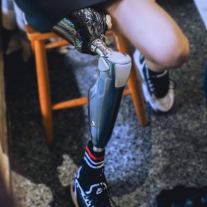 Joelho Inteligente Avançado para Amputados Transfemorais, Prótese de Joelho Biónica com Suporte Adaptativo para Caminhada em Múltiplos Terrenos - Product Image 2