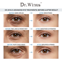 Masque pour les yeux personnalisé avec logo transparent, couleur personnalisée, hydratant, anti-poches, soin des cernes