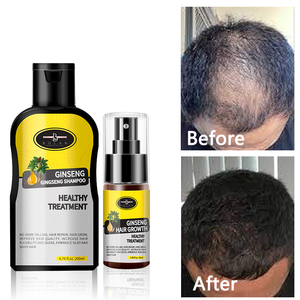 <span class=keywords><strong>ซื้อ</strong></span>ชุดผลิตภัณฑ์บำรุงเ<span class=keywords><strong>ส</strong></span>้นผม Best Solutions Tonic Anti Loss Treatment Own Label ผลิตภัณฑ์สูตรเข้มข้น แชมพูและ<span class=keywords><strong>ส</strong></span><span class=keywords><strong>เปร</strong></span><span class=keywords><strong>ย์</strong></span> <span class=keywords><strong>ส</strong></span>ำหรับการรักษาผมร่วงและกระตุ้นการเกิดใหม่ของเ<span class=keywords><strong>ส</strong></span>้นผม - Product Image 3