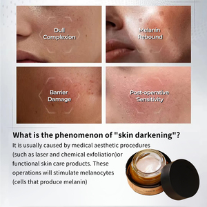 Crème de Nuit Traitante Anti-Hyperpigmentation Post-Inflammatoire pour Tous Types de Peau – Éclat du <span class=keywords><strong>Visage</strong></span> - Product Image 5