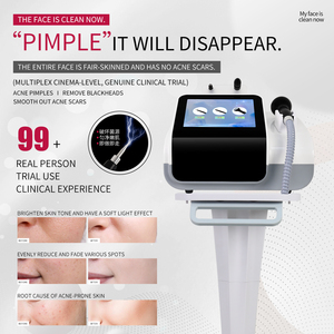 Equipo de Belleza de Escritorio con Ondas Electromagnéticas para Blanquear la Piel, Eliminar Lunares y Rejuvenecer el Rostro y el Cuerpo - Product Image 5