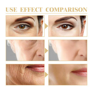 100% Naturel Anti-âge Nuit Personnaliser Lady Protection Du Visage Marque Privée Anti-Rides Collagène Crème Pour Le Visage - Product Image 5