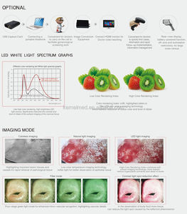 कर्नेल कोलोपोस्कोन 2200 योनि और वल्वा की महिलाओं की जांच के लिए अस्पताल स्त्री रोग परीक्षण - Product Image 5