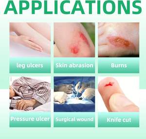 Perban Luka Serat Kalsium Alginat Medis Canggih Perlengkapan Medis - Product Image 4