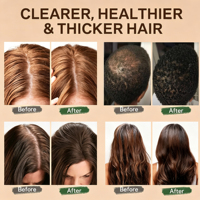 Ensemble Shampooing et Après-Shampooing Chebe Sans Sulfate pour la Croissance des Cheveux, Marque Blanche, avec Huile d'Argan, Batana et Caféine pour Cheveux Bouclés