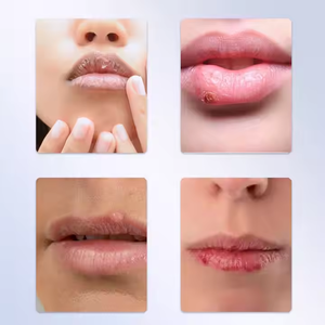 Pommade hydratante pour les soins des lèvres Fourniture de soins de santé pour traiter la sécheresse des lèvres Peeling Cracking - Product Image 4