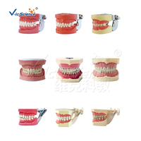 Nissin-modelo de dientes humanos de imitación, reemplazo de dientes, 32 o 28 unidades, modelo de ciencia médica, modelo educativo