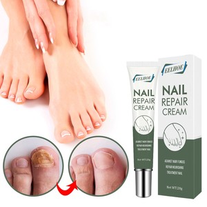 Crema per i piedi del fungo del chiodo all'ingrosso Anti infezione onicomicosi Paronychia riparazione delle unghie Gel per la rimozione dei funghi prodotti per la cura dei piedi delle mani - Product Image 1
