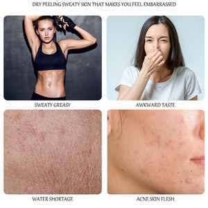 Handmade 100g Acne and Melasma Solutions Cleansing Face and Body Sakura <b>Soap</b> - Product Image 3