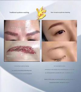 Apparecchiatura Laser Picosecondo a Tripla Lunghezza d'Onda, Rimozione Non Invasiva di Tatuaggi e Pigmenti Sopracciglia con Energia Regolabile - Product Image 2