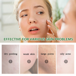 Cuidado DE LA PIEL Vegan After Sun Care con Aloe Vera Loción calmante e hidratante para quemaduras solares After Sun Burn - Product Image 4
