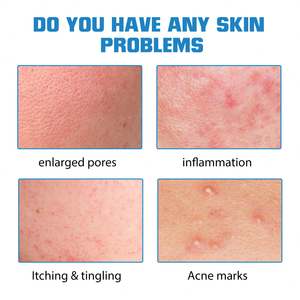 EELHOE Sérum Visage à l'<span class=keywords><strong>Acide</strong></span> Hyaluronique Actif 10ml en Gros Marque Privée Sérum Visage Bio Hydra Sérum Visage Éclaircissant Anti-Âge - Product Image 5