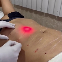 Endo Laser Machine Corps Minceur Lipolyse Dispositif 1470nm Diode Laser Liposuccion Endolaser Machine De Levage