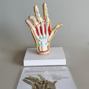 Simulateur de pathologie de la main de démonstrateur clinique de main pour l'enseignement orthopédique et rhumatologique - Product Image 5