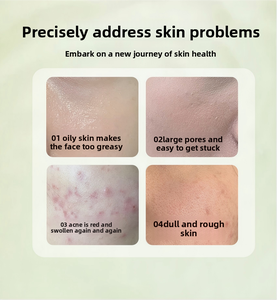 Aceite Esencial de Árbol de Té <span class=keywords><strong>Australiano</strong></span> 100% Puro Mayfield, Destilación al Vapor, Admite Especificaciones Personalizadas para Todo Tipo de Piel 1 - Product Image 2