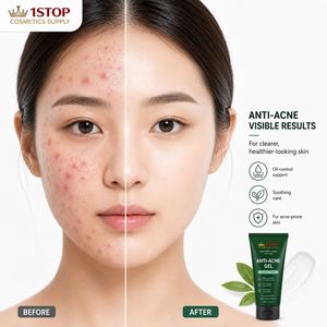 Productos Faciales, Gel con Ácido Salicílico para Piel Propensa al Acné, Resultados Visibles en Horas, Preparado para Usar - Product Image 1