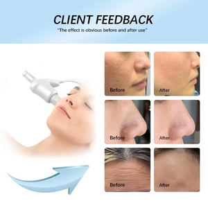 超伝導 スキンエレクトロポレーション 非侵襲 DEEPBA アンチエイジング シワケア 美容機器 - Product Image 5