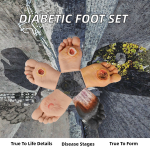 Набор анатомических моделей стопы для изучения диабетической стопы, медицинский образовательный инструмент - Product Image 2
