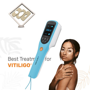 Lámpara Láser Excimer LED CN-308B de 308nm para Fototerapia UV de Uso Doméstico, para el Tratamiento del Vitiligo y la Psoriasis - Product Image 1