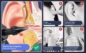 <span class=keywords><strong>Appareil</strong></span> de nettoyage d'<span class=keywords><strong>oreilles</strong></span> portable 250 ml, étanche IP67, 4 pressions, 10 embouts réutilisables <span class=keywords><strong>pour</strong></span> soins personnels des <span class=keywords><strong>oreilles</strong></span> - Product Image 6