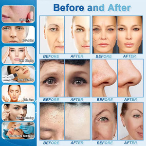 เครื่องไมโครเดอร์มาเบรชั่น 14 in 1 รุ่นขายดี เครื่องคริสตัลไมโครเดอร์มาเบรชั่น เครื่องไฮดรา เครื่องพ่นออกซิเจนสำหรับผิวหน้า เครื่องอควาเจ็ทพีล - Product Image 5