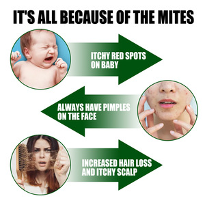 Ingredientes naturales, buen efecto rápido, productos antipolillas, <span class=keywords><strong>spray</strong></span> para eliminar ácaros. - Product Image 2