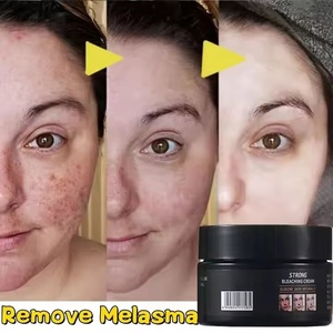 Commercio all'ingrosso crema viso Niacinamide latte principale forte sbiancamento sbiancante per le lentiggini Melasma macchie Acne melanina macchie scure - Product Image 5