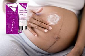 Crème Réparatrice Cutanée au Beurre de Karité de Haute Qualité, Infusée de Perles, Collagène et Aloe Vera – Puissant Éliminateur de Vergetures et Cicatrices - Product Image 3