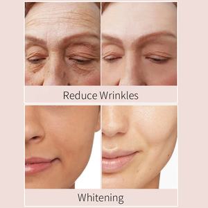 Siero schiarente schiarente schiarente della pelle del viso dell'oem con acido Kojic arbutina Niacinamide MAP vitamina C acido ialuronico - Product Image 4